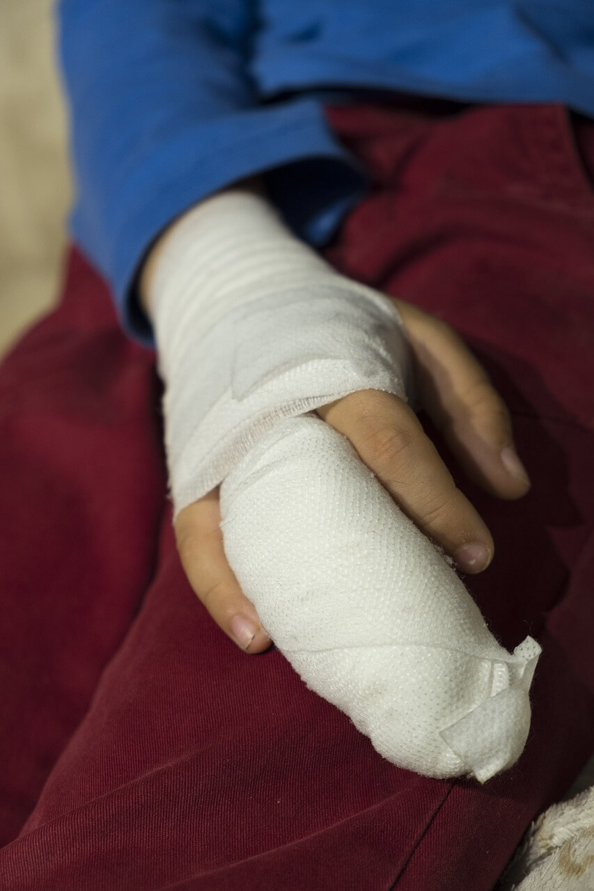 Wound Care Wound Care